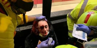 Manifestante pierde ojo durante disturbios