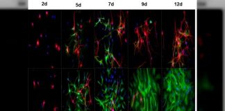 regeneración del sistema nervioso