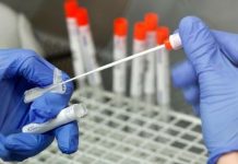 Rusia registra test sanitario para detectar la Ómicron