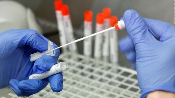 Rusia registra test sanitario para detectar la Ómicron Rusia registra test sanitario para detectar la Ómicron