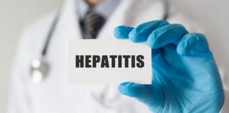 VARIANTES DE LA HEPATITIS