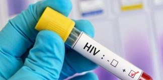 Primer fármaco contra el VIH