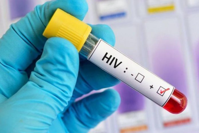 Primer fármaco contra el VIH