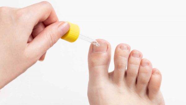 hongos en los pies