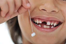 dientes de leche y sus cuidados