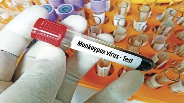 Paraguay reporta primer caso de la viruela del mono Paraguay reporta primer caso de la viruela del mono