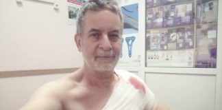 Resulta herido el corresponsal Alejandro Kirk