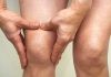 Con estos consejos puedes eliminar la hinchazón de las piernas de forma rápida hinchazón de las piernas