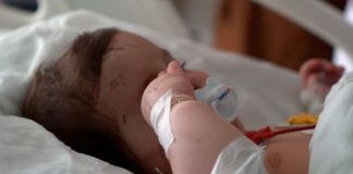 Esta bebé de seis meses, cuya cara está cubierta de cicatrices, solo es conocida como "anónima" por su etiqueta (BBC)