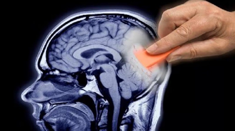 cerebro Pérdida de memoria