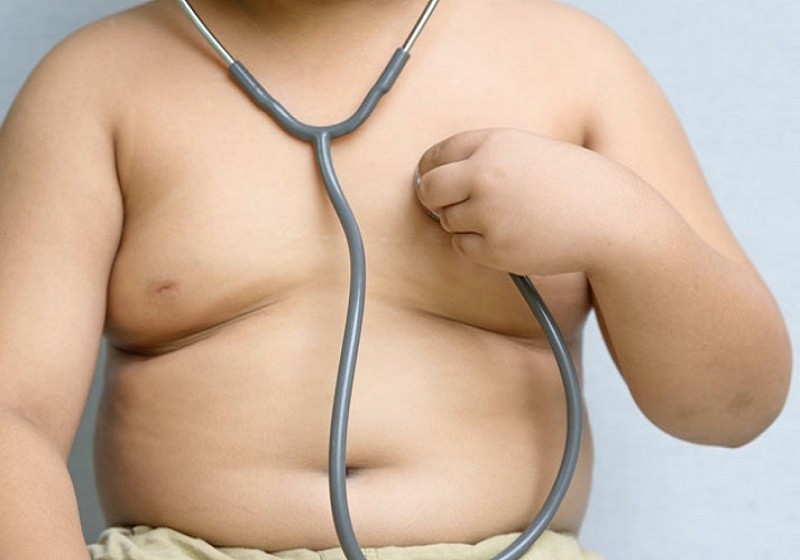 Sobrepeso infantil y coágulos sanguíneos