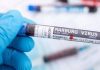 Guinea Ecuatorial reporta 11 fallecidos por fiebre de Marburgo fiebre de Marburgo