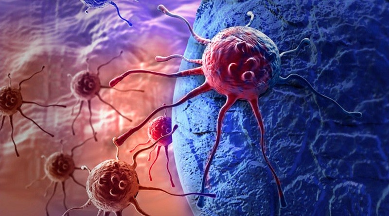 tecno Células cancerígenas