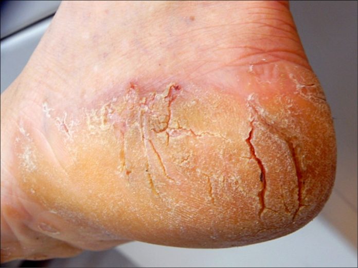 Los pies
