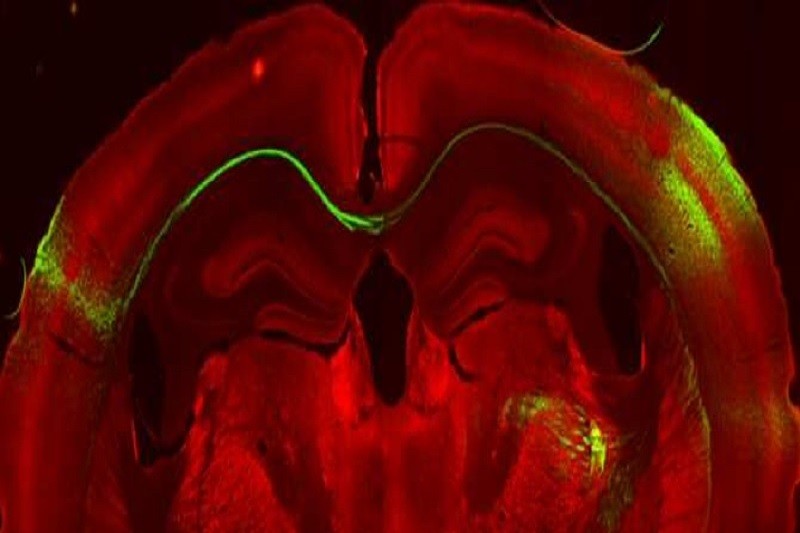 cerebro La información sensorial
