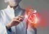 Especialista asegura que enfermedades cardiovasculares son prevenibles Las enfermedades cardiovasculares