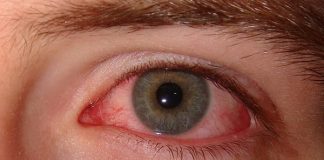 El ojo seco