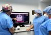 Implantes cocleares