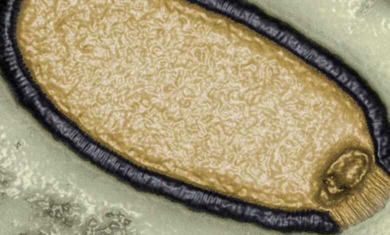 advierten-sobre-virus-zombis-del-artico-que-podrian-provocar-una-nueva-y-mortal-pandemia-141320-780x470 ‘Virus zombis’