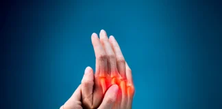 La artritis reumatoide