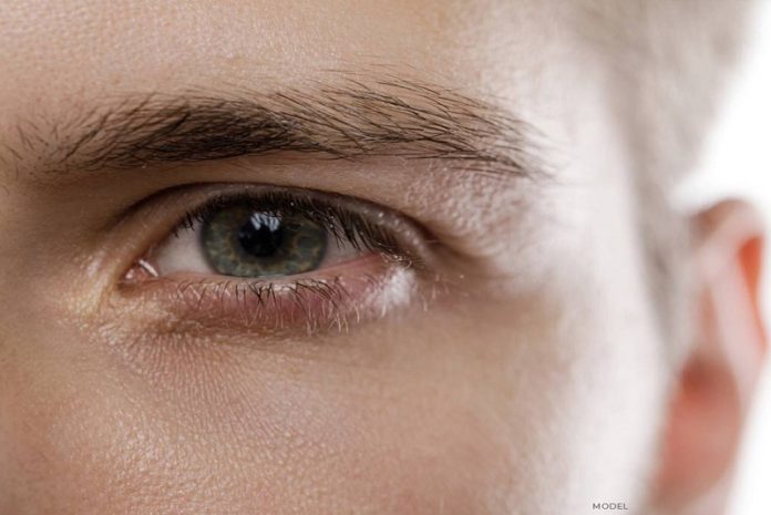 trichiasis-treatment-1 La triquiasis