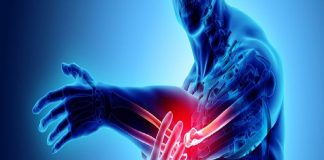 El tratamiento de lesiones tendón hueso