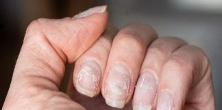 las uñas