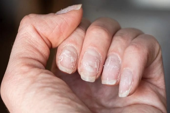 uñas cambios las uñas