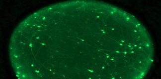 Enfermedades neurodegenerativas