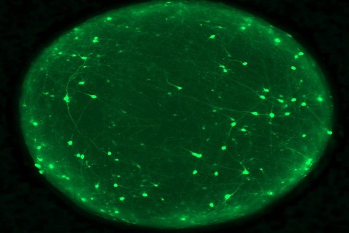 cerebro Enfermedades neurodegenerativas