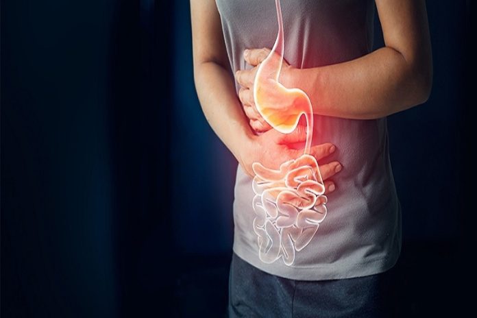 estomago Síndrome de intestino irritable