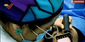 Atienden a más de 100 carabobeños en jornada quirúrgica dermatológica en la CHET