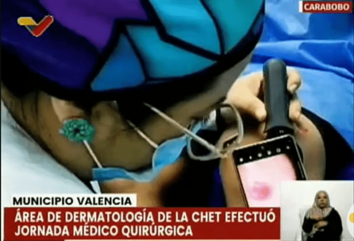 Atienden a más de 100 carabobeños en jornada quirúrgica dermatológica en la CHET Atienden a más de 100 carabobeños en jornada quirúrgica dermatológica en la CHET
