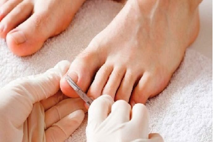 uñas2 Uñas encarnadas