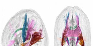 Metamorfosis cerebral del embarazo
