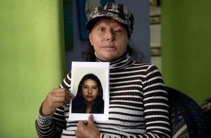 violencia ácida-víctima b