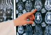 Científicos hallan un alimento capaz de regenerar las neuronas Científicos hallan un alimento