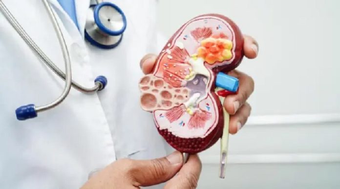 Día Mundial del Cáncer de Riñón