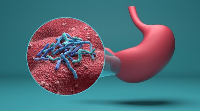El cáncer de estómago