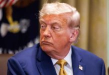 trump - insuficiencia venosa