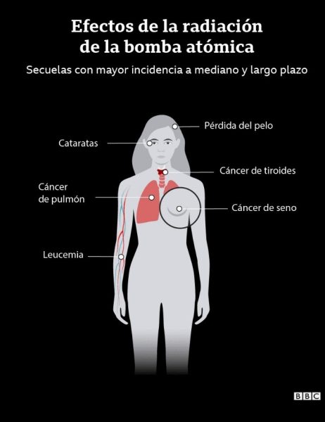 efectos de la radiación-bomba atómica