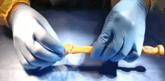 China desarrolla pegamento que repara fracturas