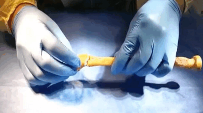 China desarrolla pegamento que repara fracturas