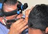 Implantes cocleares