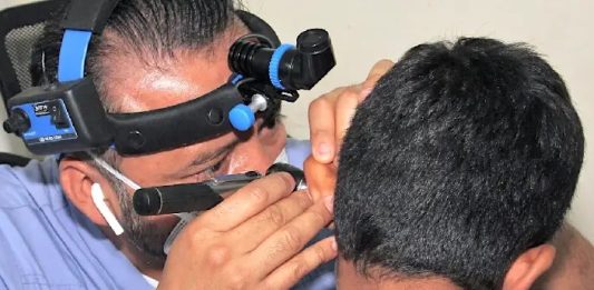 Implantes cocleares