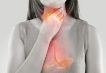 Si tienes estos malos hábitos alimenticios puedes sufrir de ERGE El reflujo gastroesofágico