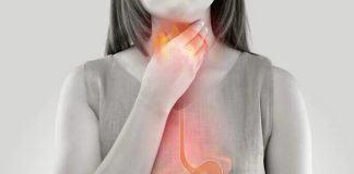 Si tienes estos malos hábitos alimenticios puedes sufrir de ERGE El reflujo gastroesofágico