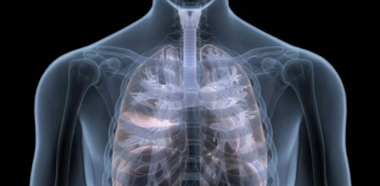 Fibrosis pulmonar: Secuela pospandemia ataca la salud global