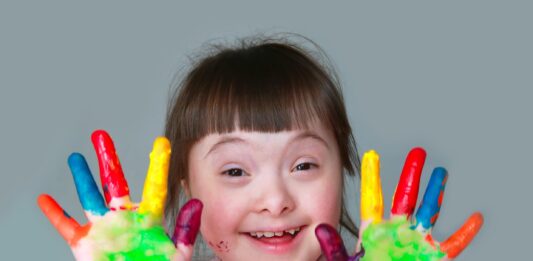 El Síndrome de Down