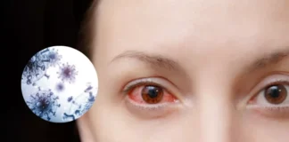 nodavirus de mortalidad encubierta